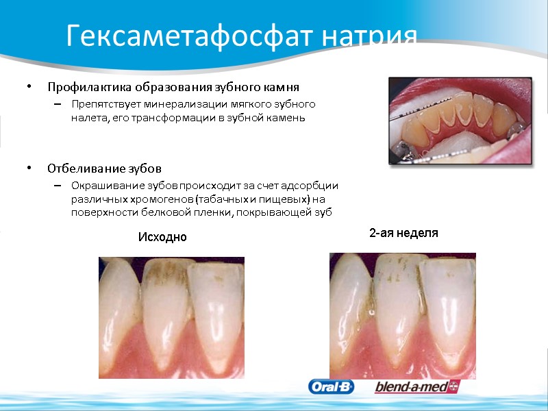 Гексаметафосфат натрия Профилактика образования зубного камня Препятствует минерализации мягкого зубного налета, его трансформации в